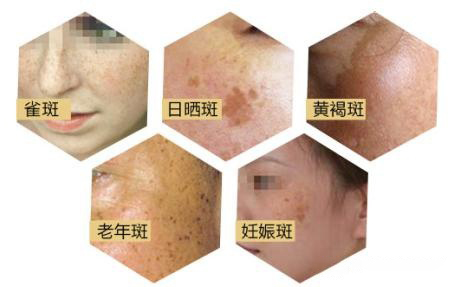 v2-13dea83c23d293b168c83dd7feeca885_720w.jpg